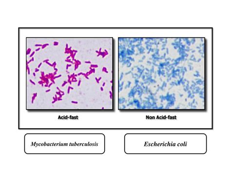 e coli acid fast stain|basic stain vs acidic stain.